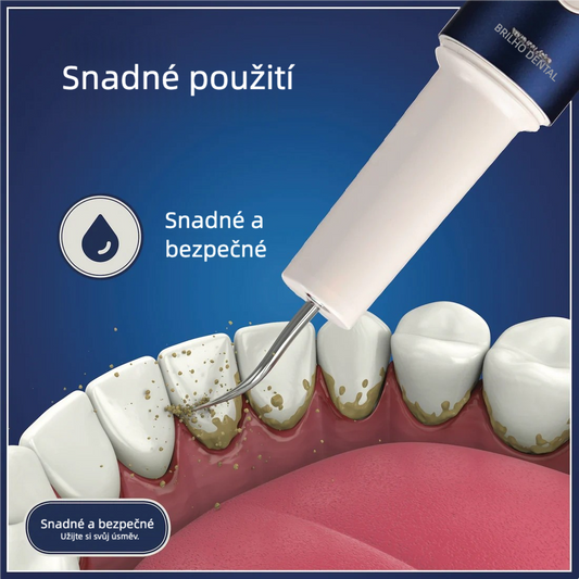 Bělejší úsměv a zdravější ústa – nový ultrazvukový dentální čistič Dentalshine!