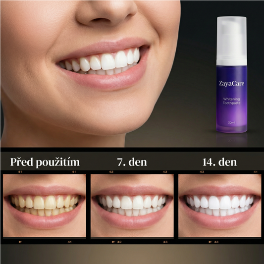 Bělící zubní pasta V34 – Intenzivní odstranění skvrn