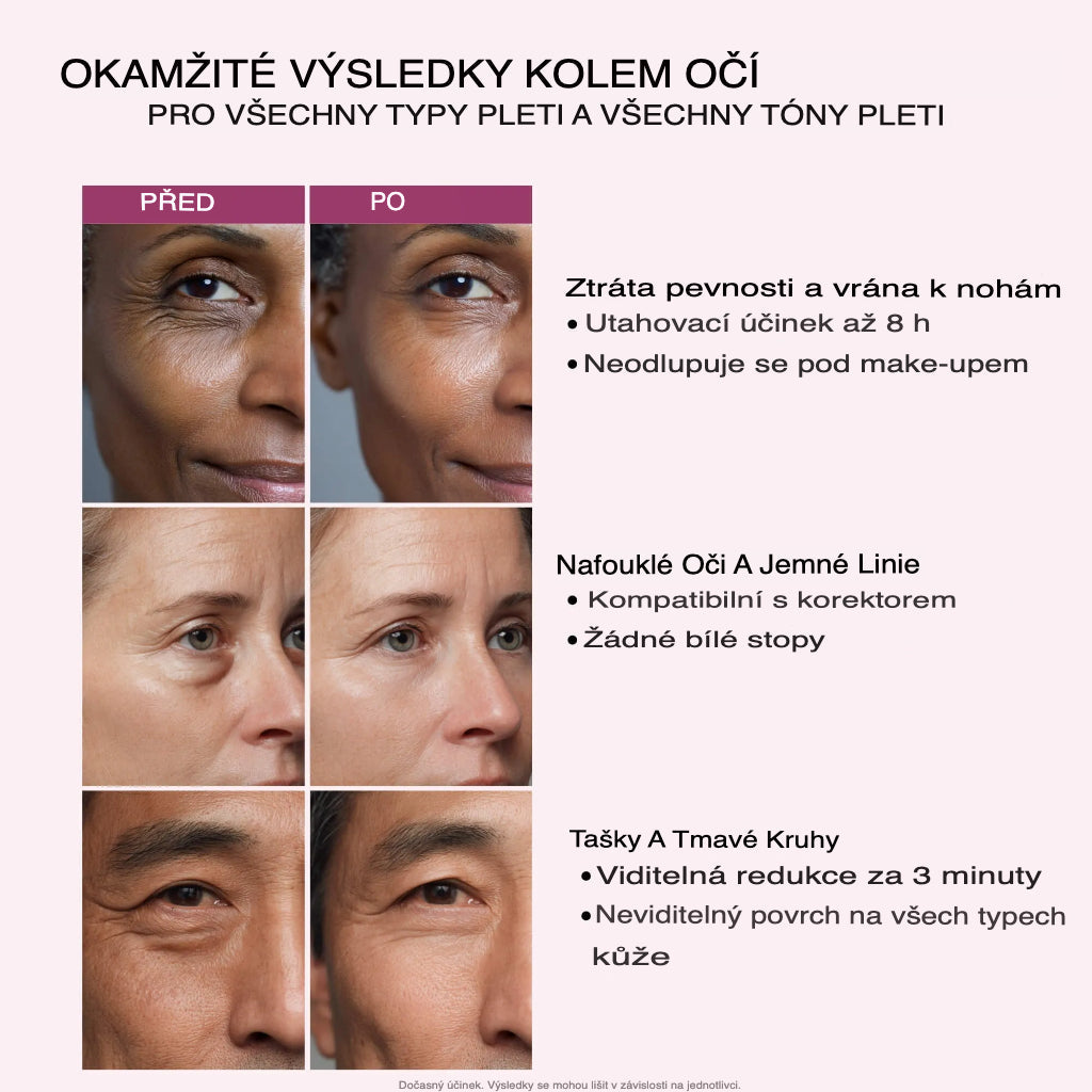 InvisiLift™ – Snižuje váčky a vrásky už za 3 minuty!